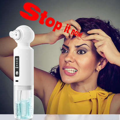 Hot Compress Small Bubble Blackhead Remover Pore Cleaning Device Beauty Instrument